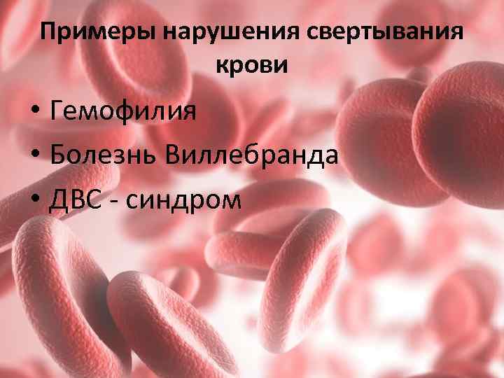 Примеры нарушения свертывания крови • Гемофилия • Болезнь Виллебранда • ДВС - синдром 