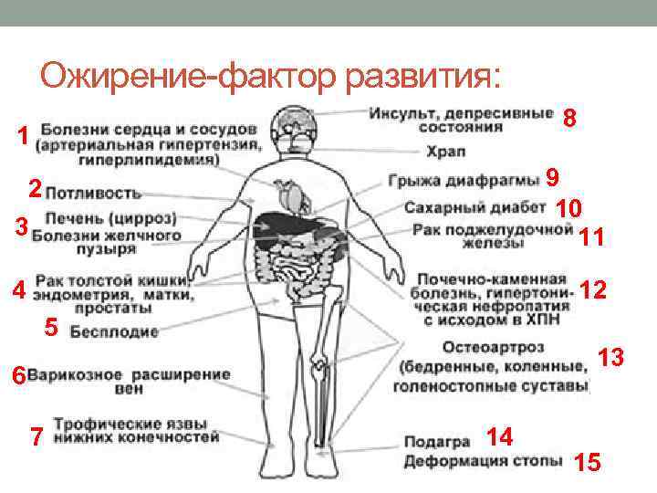 Ожирение-фактор развития: 8 1 3 9 10 11 4 12 2 5 13 6