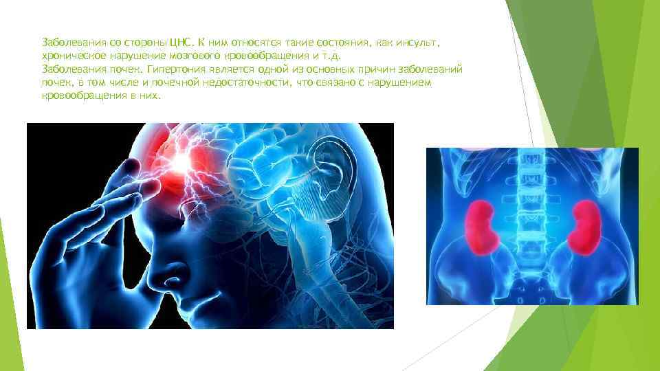 Заболевания со стороны ЦНС. К ним относятся такие состояния, как инсульт, хроническое нарушение мозгового