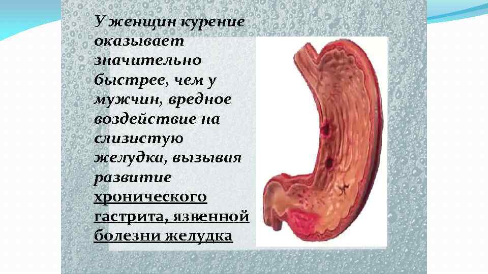 У женщин курение оказывает значительно быстрее, чем у мужчин, вредное воздействие на слизистую желудка,