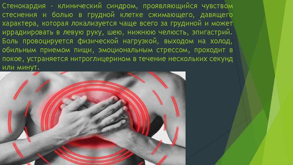 Стенокардия - клинический синдром, проявляющийся чувством стеснения и болью в грудной клетке сжимающего, давящего