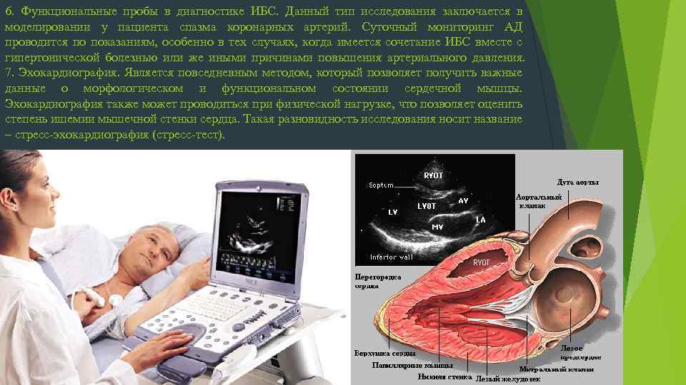6. Функциональные пробы в диагностике ИБС. Данный тип исследования заключается в моделировании у пациента