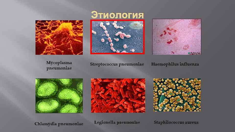 Этиология Mycoplasma pneumoniae Streptococcus pneumoniae Haemophilus influenza Chlamydia pneumoniae Legionella pneumoniae Staphilococcus aureus 