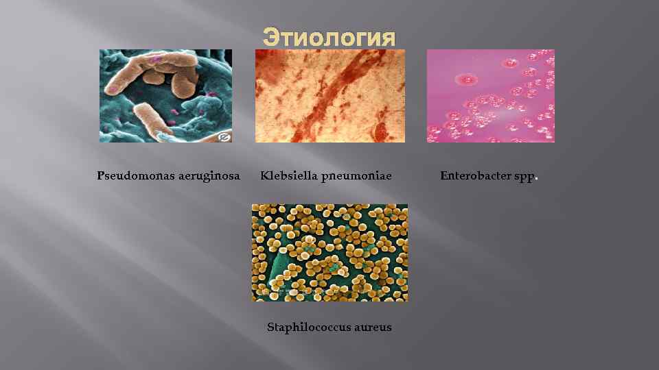 Этиология Pseudomonas aeruginosa Klebsiella pneumoniae Staphilococcus aureus Enterobacter spp. 