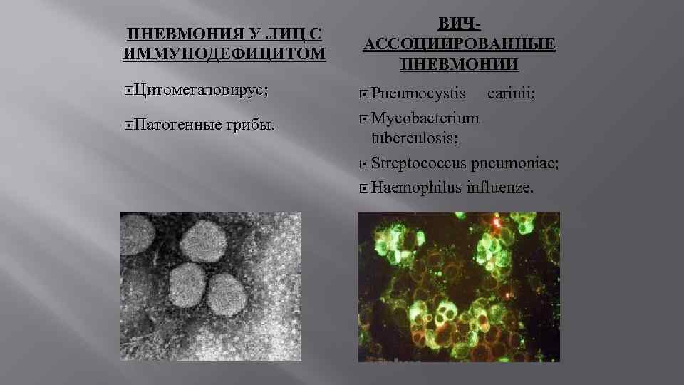 ПНЕВМОНИЯ У ЛИЦ С ИММУНОДЕФИЦИТОМ Цитомегаловирус; Патогенные грибы. ВИЧАССОЦИИРОВАННЫЕ ПНЕВМОНИИ Pneumocystis carinii; Mycobacterium tuberculosis;