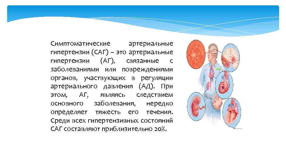 Симптоматические артериальные гипертензии (САГ) – это артериальные гипертензии (АГ), связанные с заболеваниями или повреждениями
