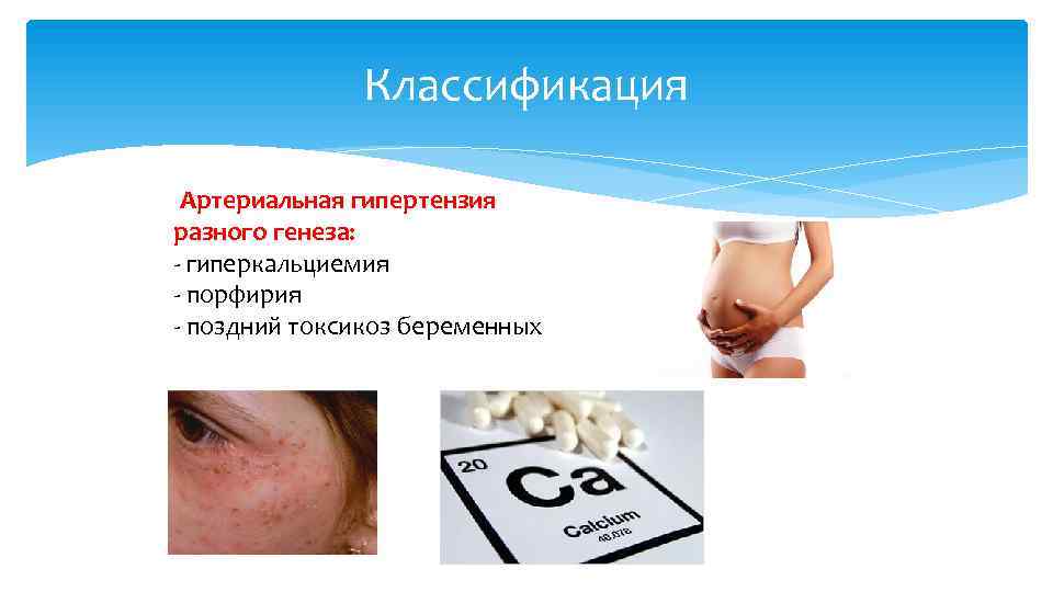 Классификация Артериальная гипертензия разного генеза: - гиперкальциемия - порфирия - поздний токсикоз беременных 
