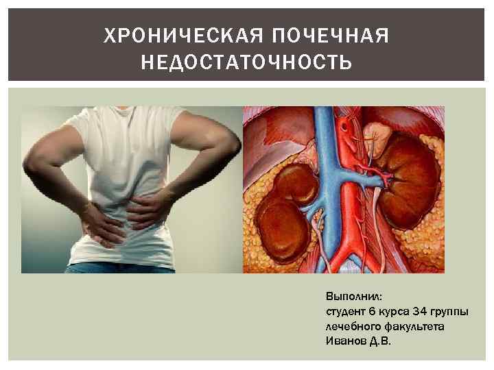 ХРОНИЧЕСКАЯ ПОЧЕЧНАЯ НЕДОСТАТОЧНОСТЬ Выполнил: студент 6 курса 34 группы лечебного факультета Иванов Д. В.
