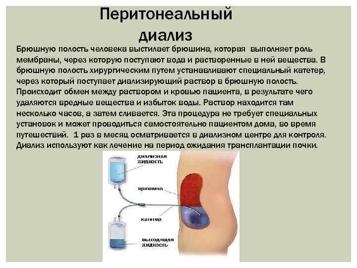 Перитонеальный диализ Брюшную полость человека выстилает брюшина, которая выполняет роль мембраны, через которую поступают