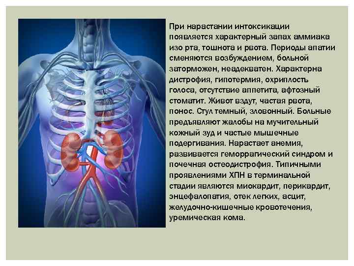 При нарастании интоксикации появляется характерный запах аммиака изо рта, тошнота и рвота. Периоды апатии