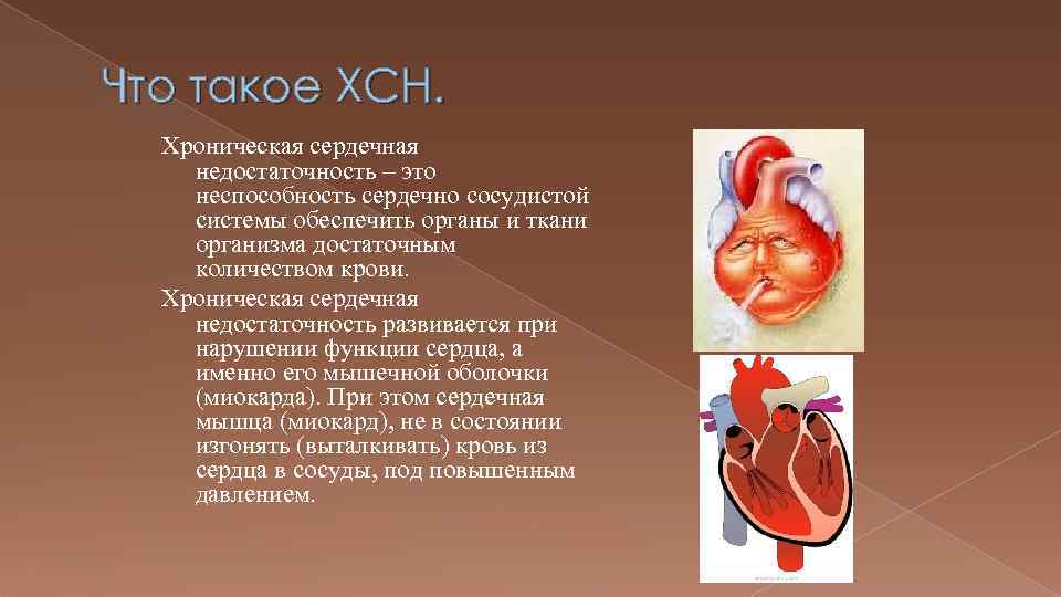 Что такое ХСН. Хроническая сердечная недостаточность – это неспособность сердечно сосудистой системы обеспечить органы