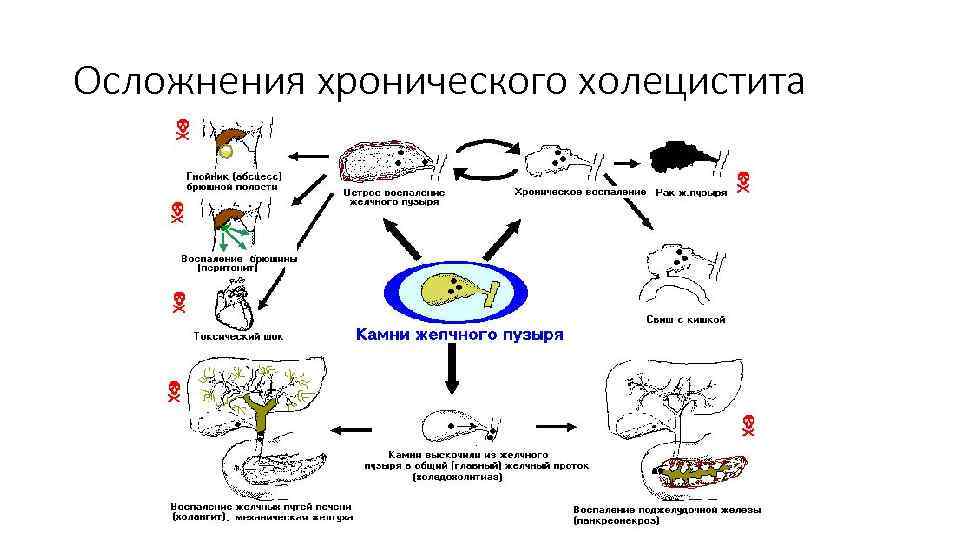 Осложнения хронического холецистита 