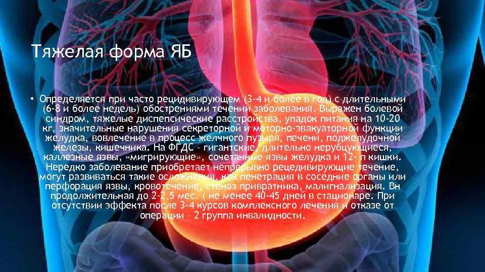 Тяжелая форма ЯБ • Определяется при часто рецидивирующем (3 -4 и более в год)