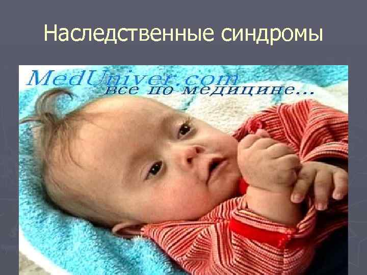 Наследственные синдромы 