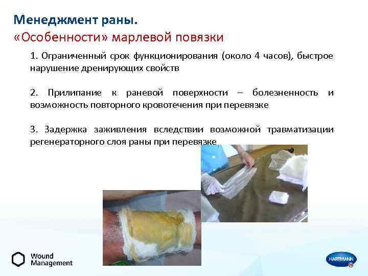 Менеджмент раны. «Особенности» марлевой повязки 1. Ограниченный срок функционирования (около 4 часов), быстрое нарушение