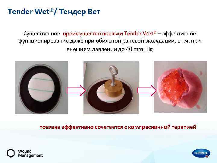 Tender Wet®/ Тендер Вет Существенное преимущество повязки Tender Wet® – эффективное функционирование даже при