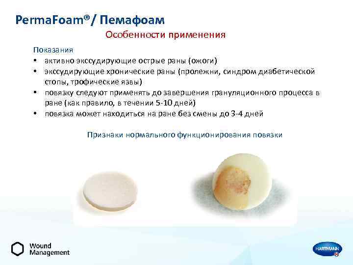 Perma. Foam®/ Пемафоам Особенности применения Показания • активно экссудирующие острые раны (ожоги) • экссудирующие