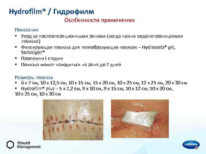 Hydrofilm® / Гидрофилм Особенности применения Показания • Уход за послеоперационными ранами (когда нужна водонепроницаемая