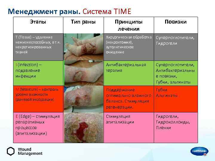 Менеджмент раны. Система TIME Этапы Тип раны Принципы лечения Повязки T (Tissue) – удаление