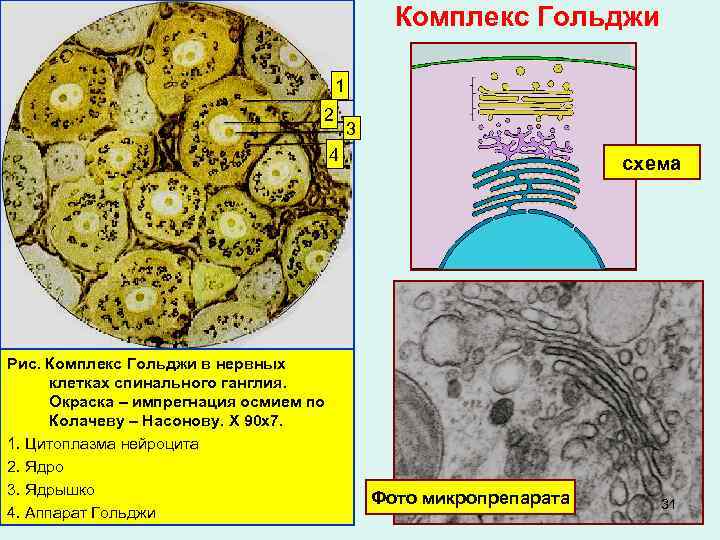 Клетка позвоночных. Комплекс Гольджи в нейронах спинального ганглия. Аппарат Гольджи гистология. Комплекс Гольджи нервные клетки спинномозгового узла. Комплекс Гольджи в нервных клетках спинального ганглия котенка.