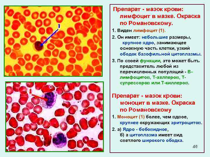  Препарат - мазок крови: лимфоцит в мазке. Окраска по Романовскому. 1. Виден лимфоцит