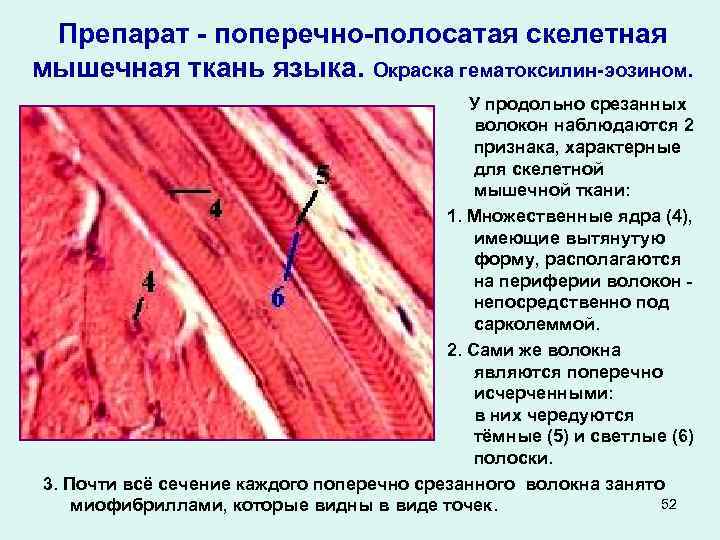 Препарат - поперечно-полосатая скелетная мышечная ткань языка. Окраска гематоксилин-эозином. У продольно срезанных волокон наблюдаются