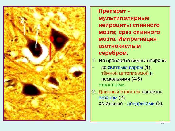  Препарат - мультиполярные нейроциты спинного мозга; срез спинного мозга. Импрегнация азотнокислым серебром. 1.