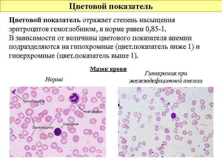 Цветовой показатель отражает степень насыщения эритроцитов гемоглобином, в норме равен 0, 85 -1. В