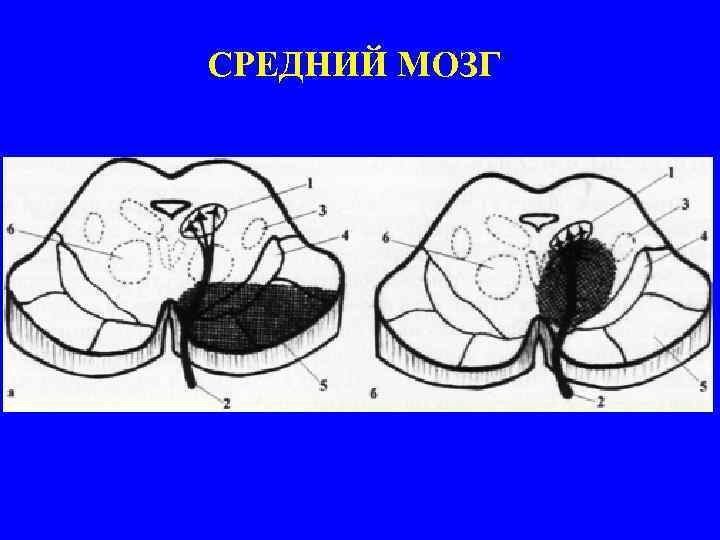 СРЕДНИЙ МОЗГ 