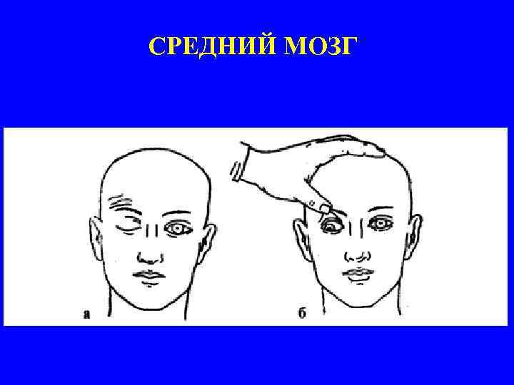СРЕДНИЙ МОЗГ 