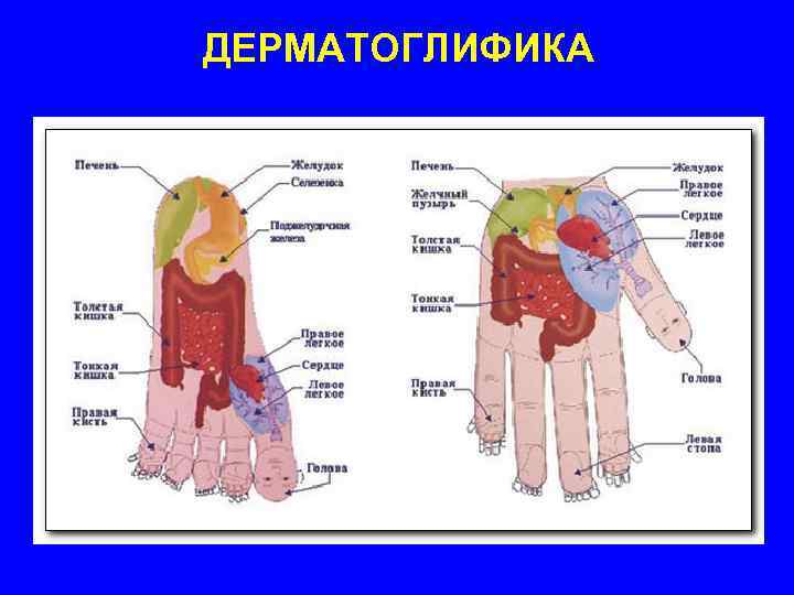 ДЕРМАТОГЛИФИКА 