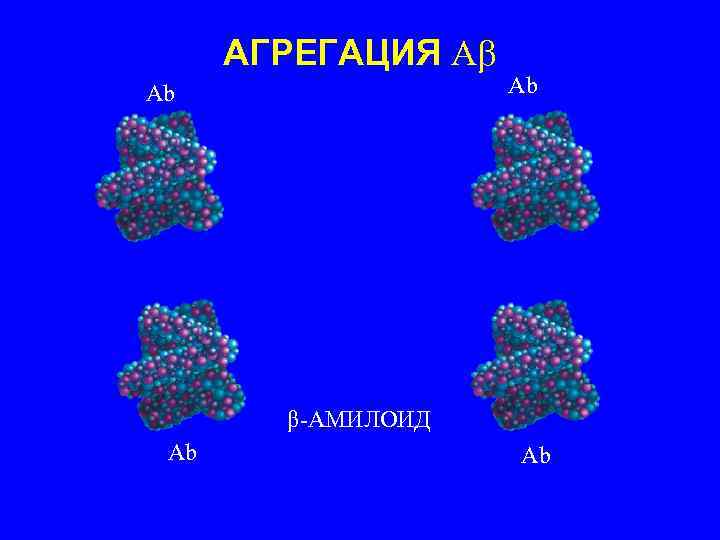 АГРЕГАЦИЯ А Аb Аb β-АМИЛОИД Аb Аb 