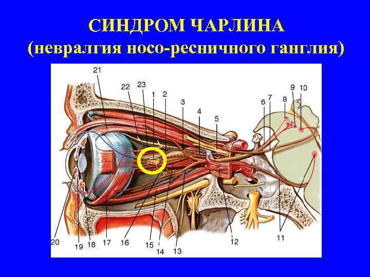 СИНДРОМ ЧАРЛИНА (невралгия носо-ресничного ганглия) 