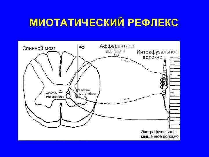 МИОТАТИЧЕСКИЙ РЕФЛЕКС 