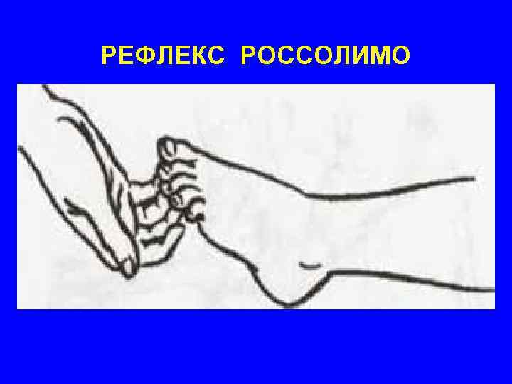 РЕФЛЕКС РОССОЛИМО 