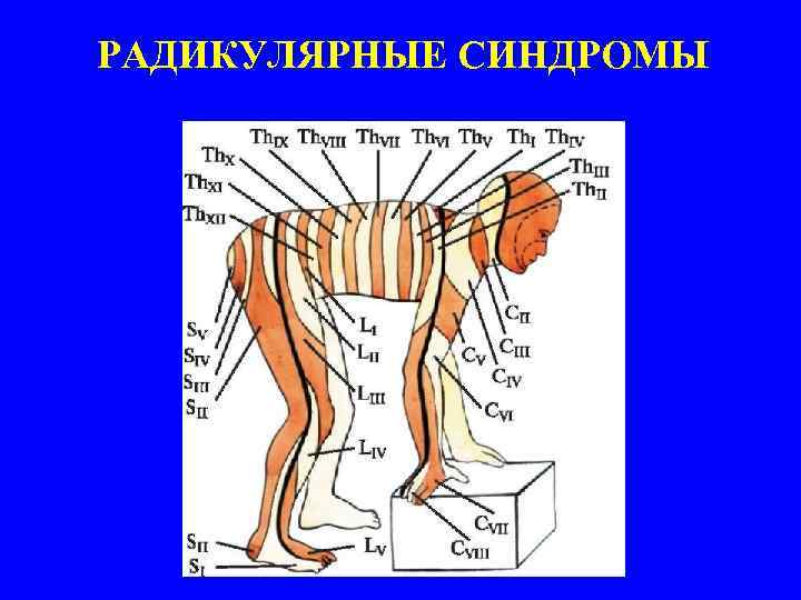 Карта вызова смп радикулопатия пояснично крестцового отдела