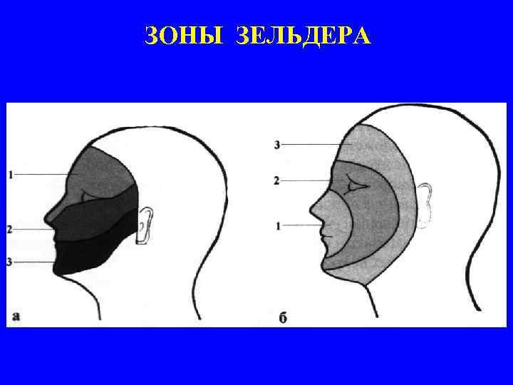 ЗОНЫ ЗЕЛЬДЕРА 