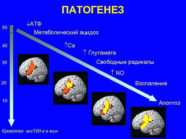 Ацидоз клиническая картина