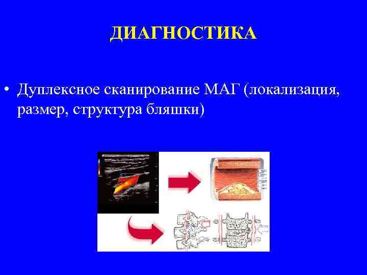 Дуплексное сканирование магистральных артерий головы