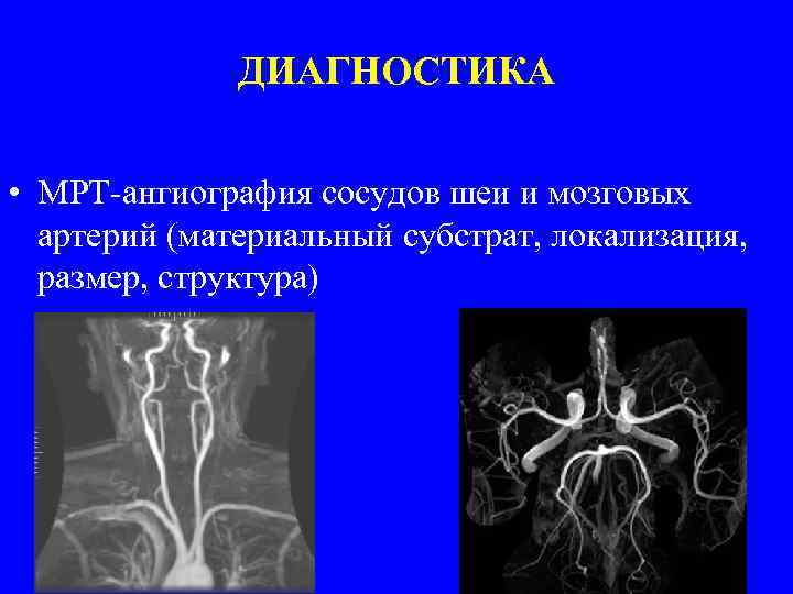 Мрт головного мозга и сосудов фото процедуры