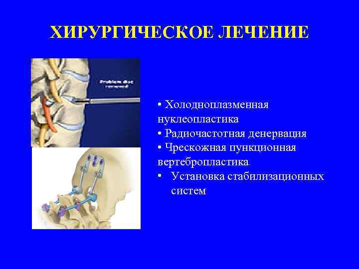 ХИРУРГИЧЕСКОЕ ЛЕЧЕНИЕ • Холодноплазменная нуклеопластика • Радиочастотная денервация • Чрескожная пункционная вертебропластика • Установка