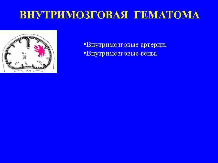ВНУТРИМОЗГОВАЯ ГЕМАТОМА • Внутримозговые артерии. • Внутримозговые вены. 
