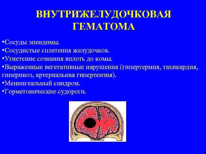 ВНУТРИЖЕЛУДОЧКОВАЯ ГЕМАТОМА • Сосуды эпендимы. • Сосудистые сплетения желудочков. • Угнетение сознания вплоть до
