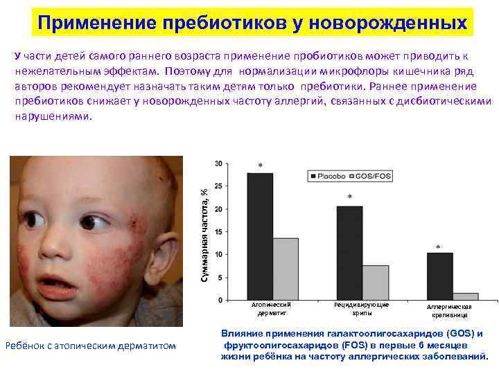 Применение пребиотиков у новорожденных У части детей самого раннего возраста применение пробиотиков может приводить