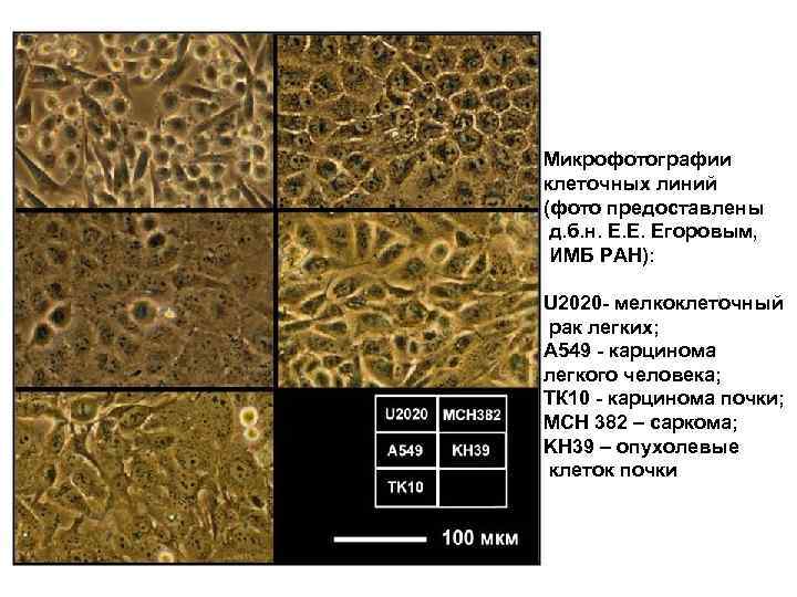 Микрофотографии клеточных линий (фото предоставлены д. б. н. Е. Е. Егоровым, ИМБ РАН): U