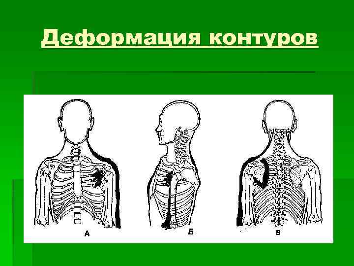 Деформация контуров 