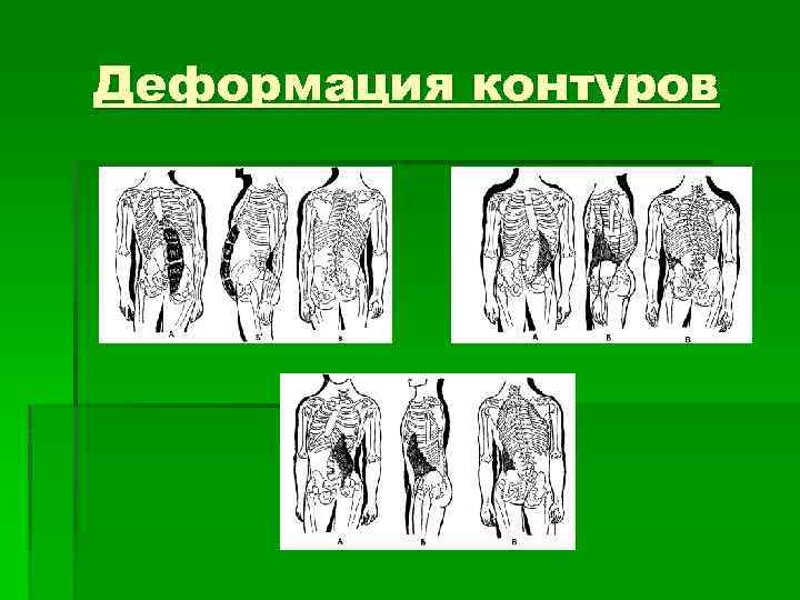 Деформация контуров 