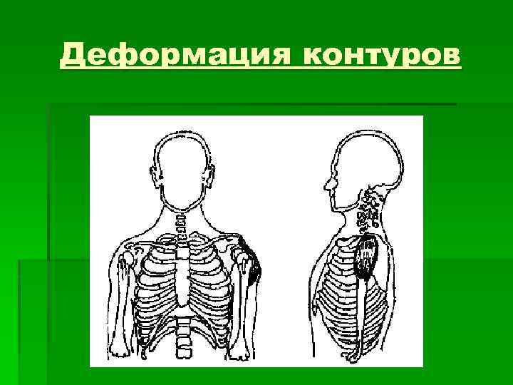 Деформация контуров 