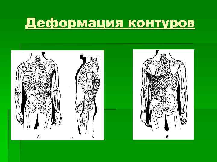 Деформация контуров 