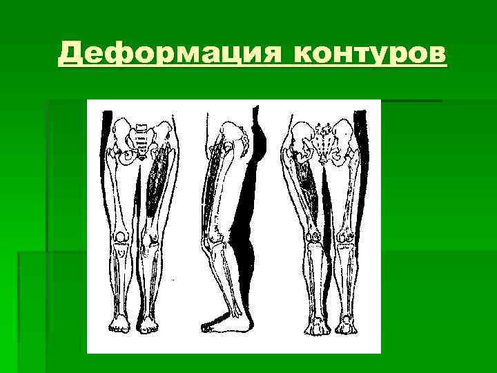 Деформация контуров 